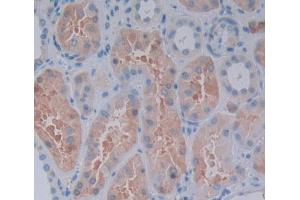 Used in DAB staining on fromalin fixed paraffin- embedded Kidney tissue (RIPK2 anticorps  (AA 432-540))