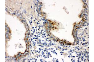 IHC(P): Human Prostatic Cancer Tissue (PTP4A2 anticorps  (N-Term))