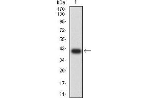 Western blot analysis using BTRC mAb against human BTRC (AA: 24-151) recombinant protein.