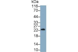 Detection of IFNg in Cavia Testis lysate using Monoclonal Antibody to Interferon Gamma (IFNg) (Interferon gamma anticorps  (AA 24-166))