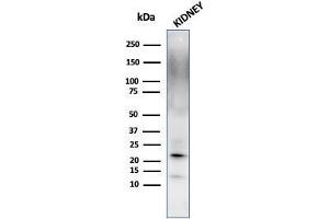 SDS-PAGE Analysis Purified Ferritin, Light Chain Mouse Monoclonal Antibody (FTL/1389).
