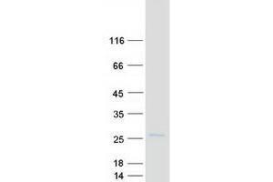 Validation with Western Blot