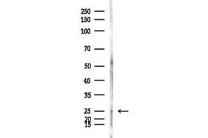 Western blot analysis of lysates from HepG2 cells(heat-shock,45 min treatment), using TNFRSF10C Antibody at 1/1000 dilution.
