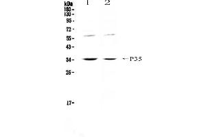 Western blot analysis of IL12A using anti-IL12A antibody .