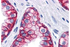 Immunohistochemistry staining of human prostate (paraffin sections) using anti-CD326 (VU-1D9). (EpCAM anticorps)