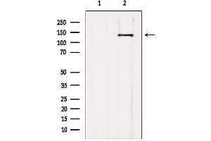 Western blot analysis of extracts from mouse brain, using CCP1 antibody. (AGTPBP1 anticorps  (Internal Region))