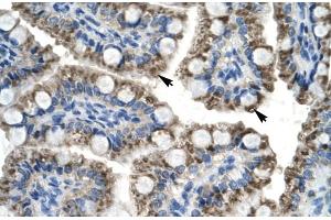 Rabbit Anti-C20orf100 Antibody Catalog Number: ARP30008 Paraffin Embedded Tissue: Human Intestine Cellular Data: Epithelial cells of intestinal villas Antibody Concentration: 4.