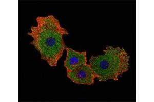 Fluorescent confocal image of MCF-7 cell stained with SMAD9 antibody at 1:25.