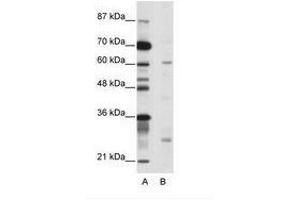 Image no. 1 for anti-Nuclear Receptor Subfamily 1, Group I, Member 2 (NR1I2) (C-Term) antibody (ABIN203170)