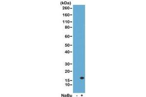 Western Blot of acid extracts from human HeLa cells untreated (-) or treated (+) with sodium butyrate using the recombinant H3K14ac antibody at 0. (Recombinant Histone 3 anticorps  (acLys14))