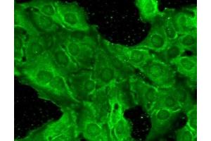 Immunocytochemistry/Immunofluorescence analysis using Mouse Anti-GluN2B/NR2B Monoclonal Antibody, Clone S59-36 (ABIN2483220).