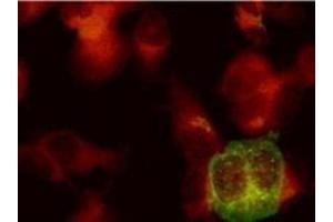 Immunofluorescence (IF) image for anti-Herpes Simplex Virus Type 2, Glycoprotein E (HSV2 gE) antibody (ABIN265568) (HSV-2 gE anticorps)