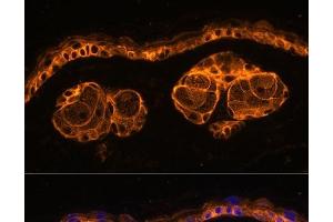 Immunofluorescence analysis of Mouse skin using KRT14 Polyclonal Antibody at dilution of 1:100.