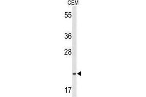 Western blot analysis of TIFA Antibody (N-term) in CEM cell line lysates (35 µg/lane). (TIFA anticorps  (N-Term))