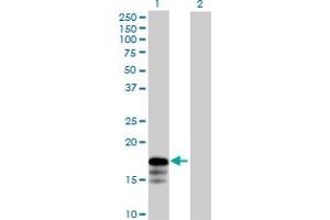 Western Blot analysis of RNF181 expression in transfected 293T cell line by RNF181 MaxPab polyclonal antibody.