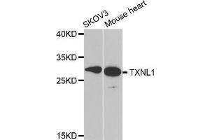 Western blot analysis of extracts of various cell lines, using TXNL1 antibody (ABIN5973739) at 1/1000 dilution.