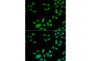 Immunofluorescence analysis of  cells using INTS10 antibody (ABIN6129778, ABIN6142484, ABIN6142486 and ABIN6217410).