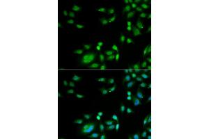 Immunofluorescence analysis of  cells using INTS10 antibody (ABIN6129778, ABIN6142484, ABIN6142486 and ABIN6217410). (INTS10 anticorps  (AA 451-710))