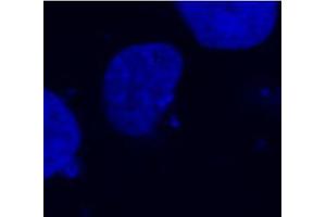 Fig. (DDDDK Tag anticorps)