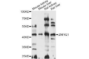Western blot analysis of extracts of various cell lines, using ZNF621 antibody (ABIN6291114) at 1:1000 dilution.