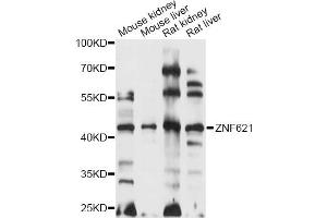 Western blot analysis of extracts of various cell lines, using ZNF621 antibody (ABIN6291114) at 1:1000 dilution. (ZNF621 anticorps)