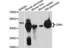Western blot analysis of extracts of various cell lines, using CPB1 antibody (ABIN4903360) at 1:1000 dilution.