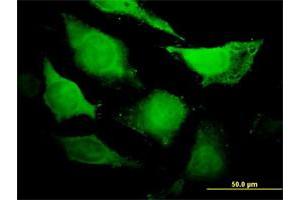 Immunofluorescence of purified MaxPab antibody to CDC45L on HeLa cell.