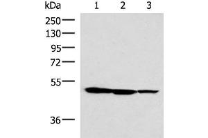 Western blot analysis of HepG2 K562 and A172 cell lysates using TTC38 Polyclonal Antibody at dilution of 1:1000 (TTC38 anticorps)