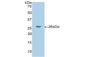 Detection of Recombinant JAG1, Human using Polyclonal Antibody to Jagged 1 (JAG1) (JAG1 anticorps  (AA 33-250))
