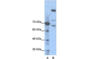 WB Suggested Anti-GLI1 Antibody Titration:  1. (GLI1 anticorps  (N-Term))