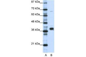 HNRPDL antibody used at 1 ug/ml to detect target protein. (HNRPDL anticorps  (Middle Region))