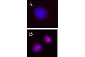 Image no. 1 for anti-Aurora Kinase B (AURKB) (pThr232) antibody (ABIN230502) (Aurora Kinase B anticorps  (pThr232))