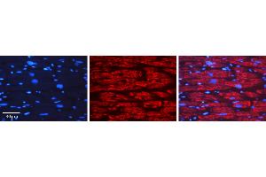 Rabbit Anti-GAPDH Antibody   Formalin Fixed Paraffin Embedded Tissue: Human Heart Muscle Tissue Observed Staining: Cytoplasm Primary Antibody Concentration: 1:600 Other Working Concentrations: N/A Secondary Antibody: Donkey anti-Rabbit-Cy3 Secondary Antibody Concentration: 1:200 Magnification: 20X Exposure Time: 0.