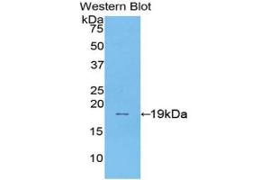 Western blot analysis of the recombinant protein. (Sucrase Isomaltase anticorps  (AA 1717-1827))