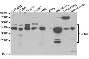 Western blot analysis of extracts of various cell lines, using EFNA1 antibody (ABIN5973078) at 1/1000 dilution.