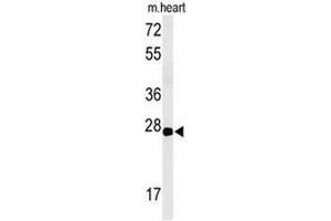 Western blot analysis of CLDN4 Antibody (C-term) in mouse heart tissue lysates (35µg/lane). (Claudin 4 anticorps  (C-Term))