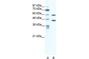 Western Blotting (WB) image for anti-Cation Channel, Sperm Associated 2 (CATSPER2) antibody (ABIN2461149) (CATSPER2 anticorps)