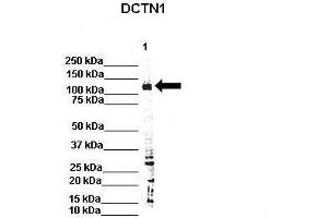 WB Suggested Anti-Dctn1 Antibody  Positive Control: Lane 1: 80ug rat brain extract Primary Antibody Dilution :  1:500 Secondary Antibody : IRDye 800 CW goat anti-rabbit from Li-COR Bioscience Secondry Antibody Dilution :  1:20,000 Submitted by: Dr.