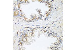 Immunohistochemistry of paraffin-embedded human prostate using HPSE2 antibody at dilution of 1:100 (40x lens). (Heparanase 2 anticorps)