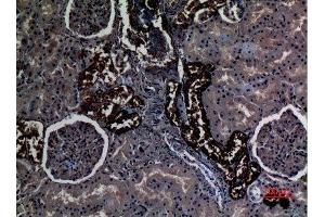 Immunohistochemistry (IHC) analysis of paraffin-embedded Human Kidney, antibody was diluted at 1:100. (RHCG anticorps  (Internal Region))