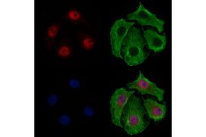 ABIN6265182 and ABIN6277544 staining Hela cells by IF/ICC.