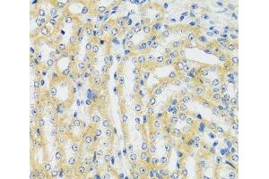 Immunohistochemistry of paraffin-embedded Mouse kidney using CAMK1 Polyclonal Antibody at dilution of 1:100 (40x lens).