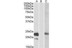 HEK293 lysate (10 µg protein in RIPA buffer) overexpressing Human CST8 with C-terminal MYC tag probed with AP21268PU-N (1ug/ml) in Lane A and probed with anti-MYC Tag (1/1000) in Lane C.