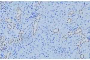 ABIN6279586 at 1/100 staining Mouse kidney tissue by IHC-P. (MT-ND2 anticorps)