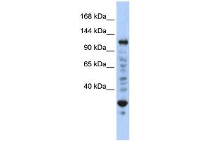 WB Suggested Anti-NFX1 Antibody Titration:  0. (NFX1 anticorps  (N-Term))