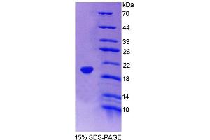 SDS-PAGE analysis of Human ICAM3 Protein. (ICAM-3/CD50 Protéine)