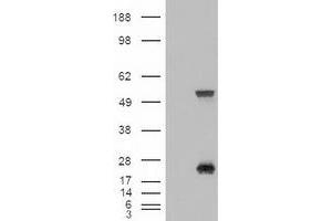 Western Blotting (WB) image for anti-Sonic Hedgehog (SHH) (AA 24-197) antibody (ABIN1491249) (Sonic Hedgehog anticorps  (AA 24-197))