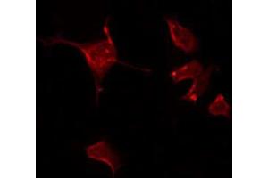 anti-Disabled Homolog 1 (Drosophila) (DAB1) (pTyr232) antibody