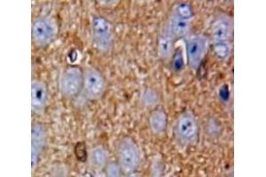 Used in DAB staining on fromalin fixed paraffin-embedded Brain tissue (CILP anticorps  (AA 604-864))