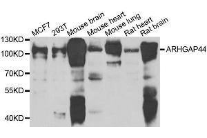 Western blot analysis of extracts of various cell lines, using ARHGAP44 antibody. (ARHGAP44 anticorps  (AA 666-772))